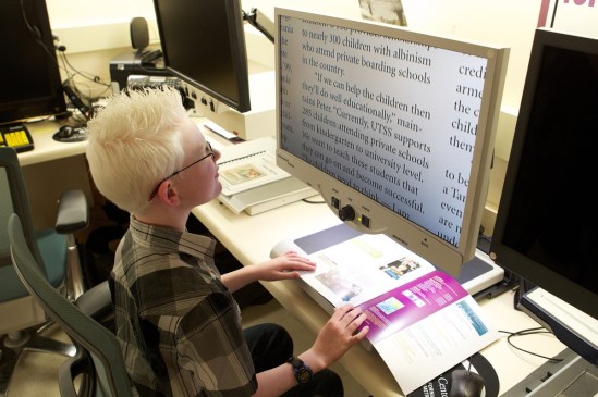A low vision patient using adaptive technology: a digital camera provides an image on a large screen giving the patient ample magnification